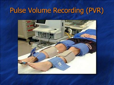 Pulse Volume Recording: PVR Test .